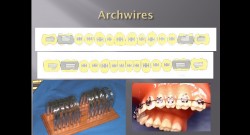 (실습 4) Bracket DBS, Archwire Placement, Tie-in 실습