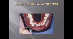 (실습 6) SS Open Coil Spring을 Tie in 하는 방법