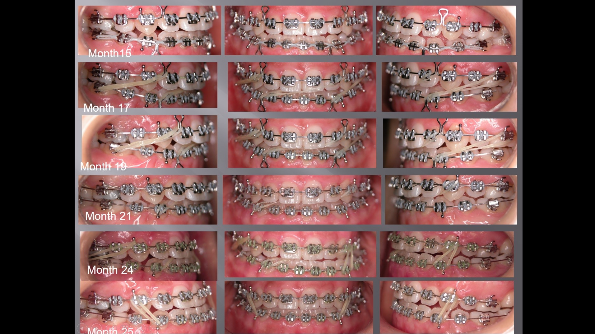 (강의 2) Sem #1 : SyL Ortho Diagnosis Form (Part 2)