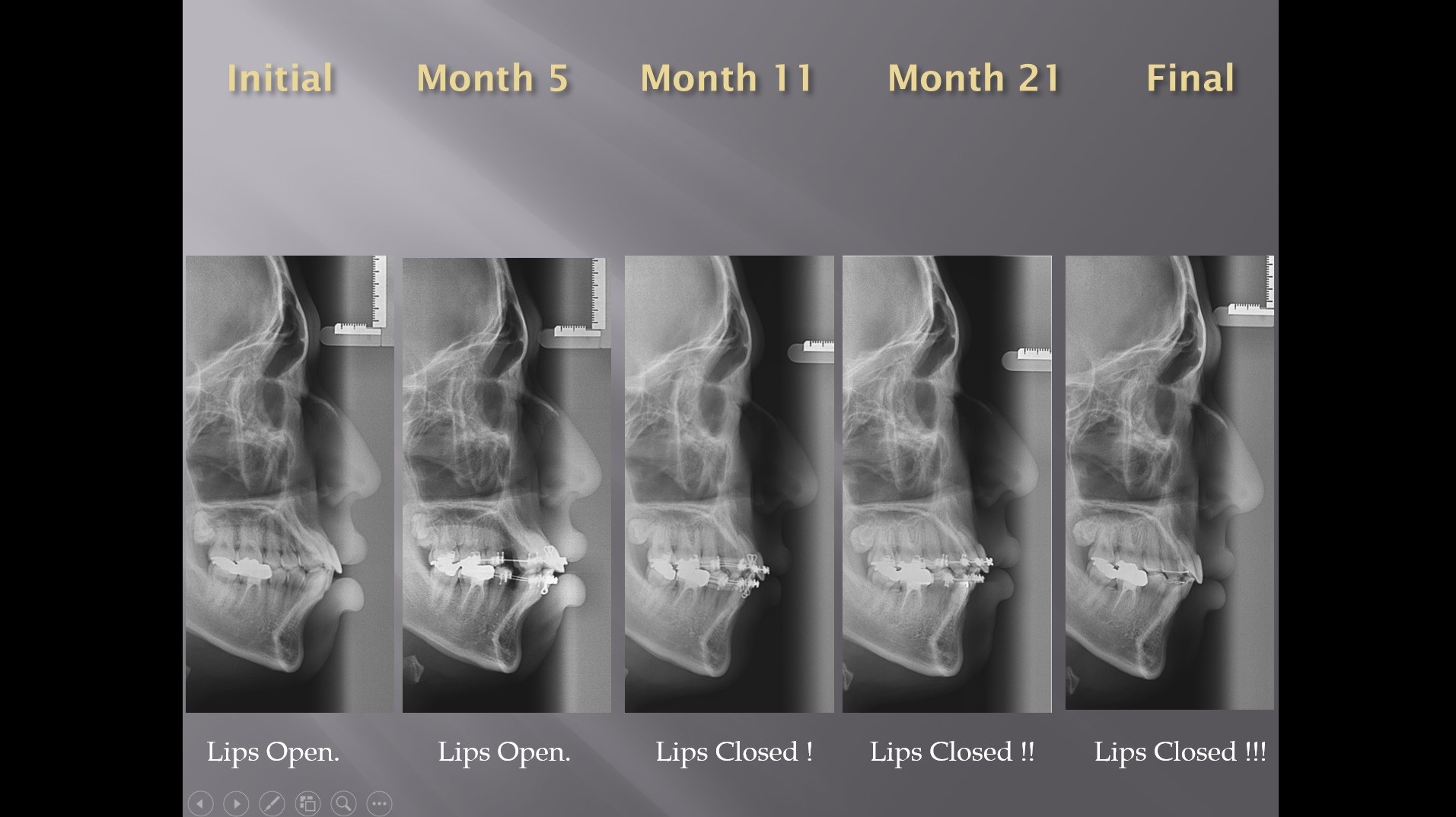 (강의 2) Sem #1 : SyL Ortho Diagnosis Form (Part 5)