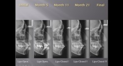 (강의 2) Sem #1 : SyL Ortho Diagnosis Form (Part 5)