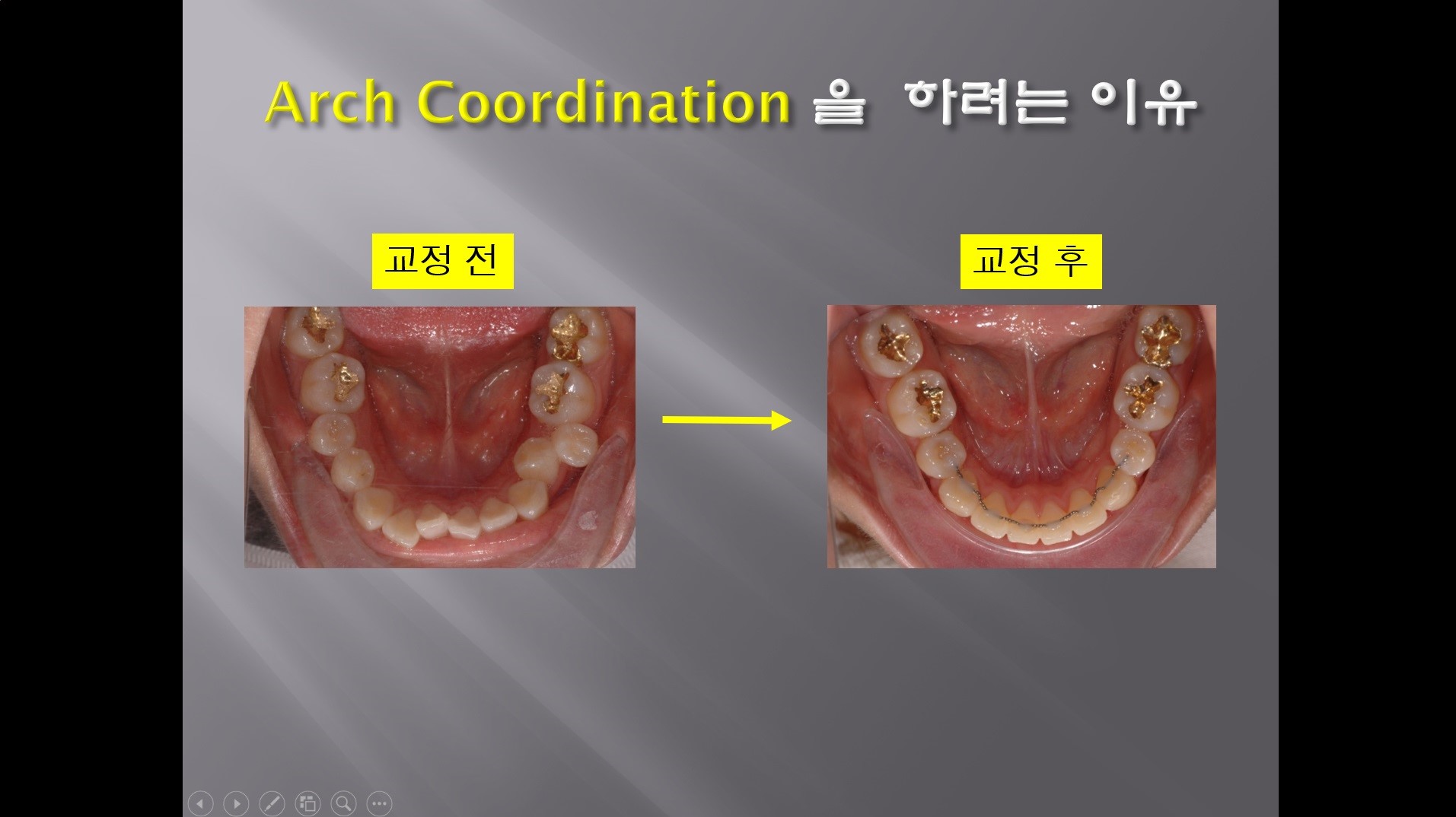 (실습 18) Arch Coordination