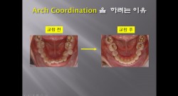 (실습 18) Arch Coordination