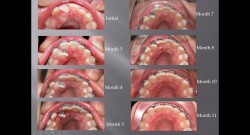 (강의 6) Sem #2 : 사진 촬영