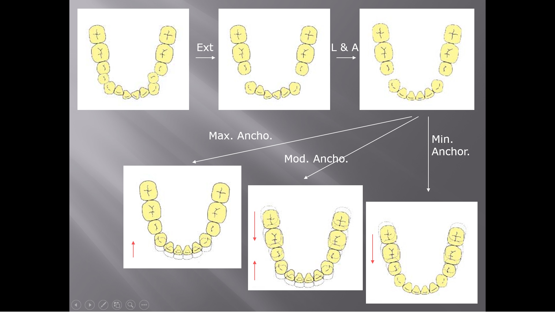 (강의 8) Sem #2 : Protrusion, Anchorage and Extraction 이해