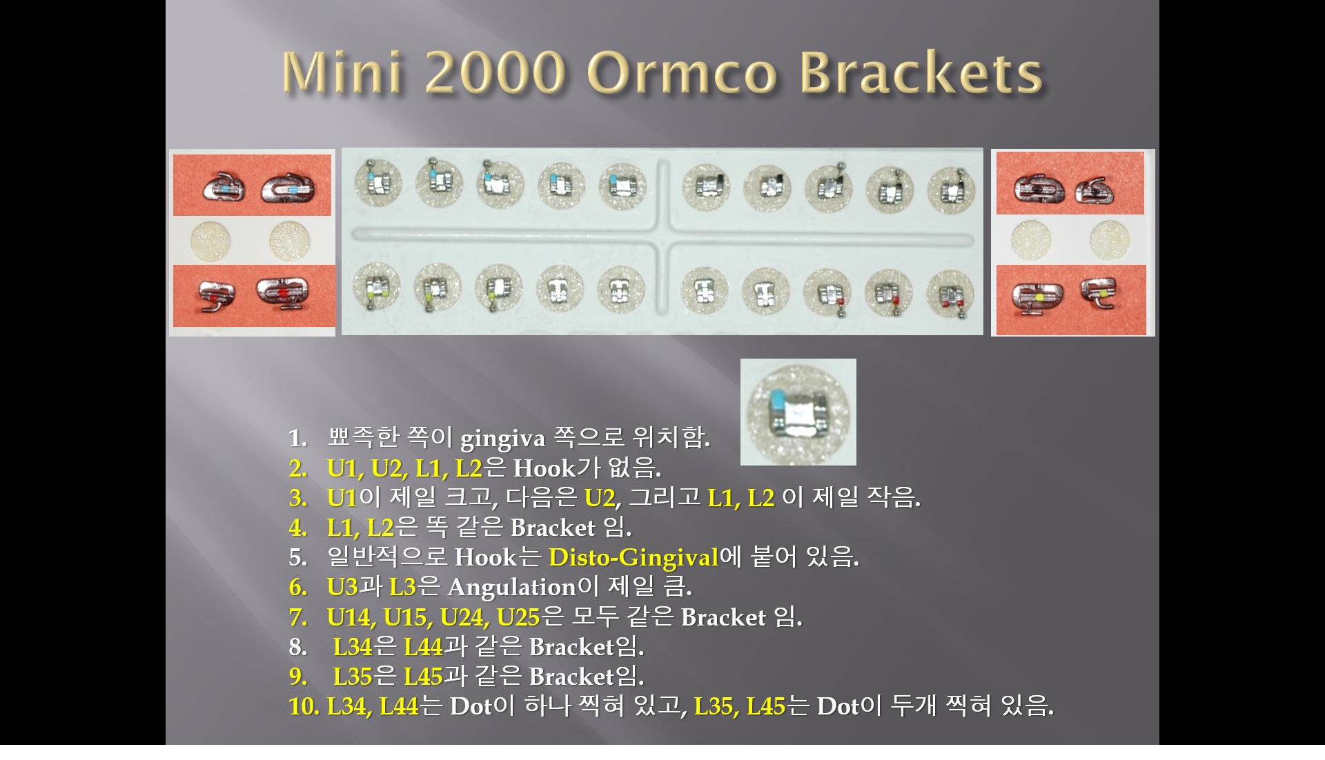 (강의 11) Sem #3 : Bracket, Band, Archwire (Part 1)