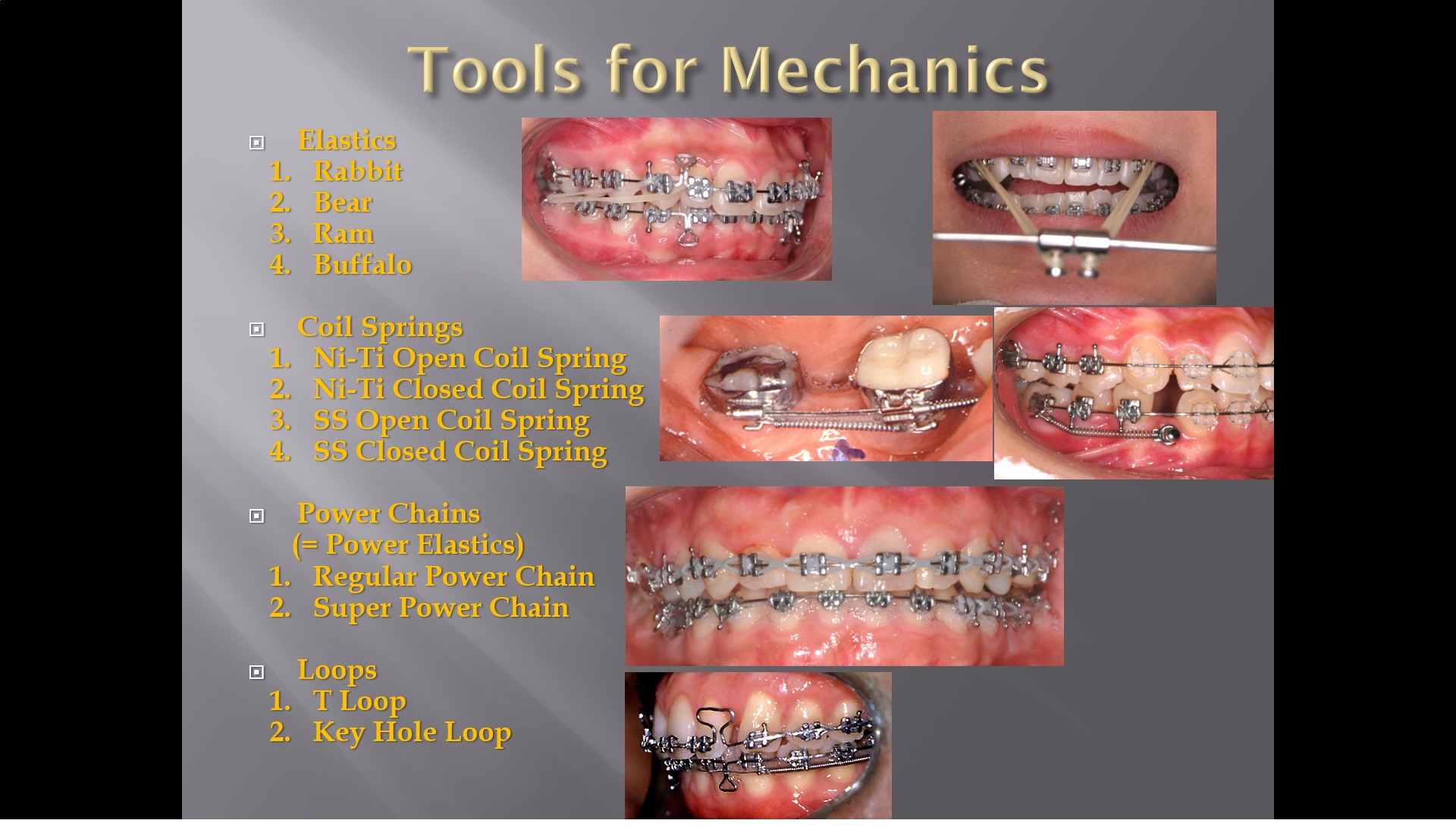 (강의 15) Sem #4 : 교정 Mechanics Tools (Part 1)