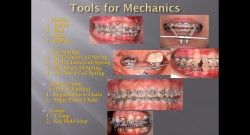 (강의 15) Sem #4 : 교정 Mechanics Tools (Part 1)