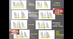 (강의 16) Sem #5 : Mechanics (Part 2)