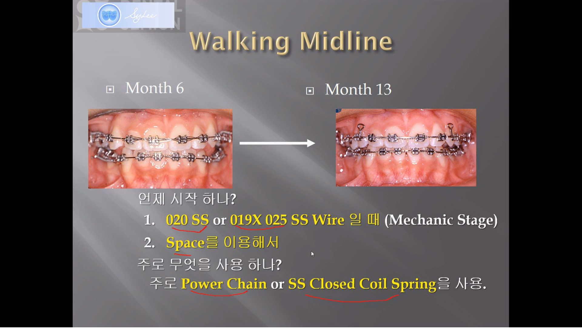 (강의 19) Sem #6 : Midline Correction