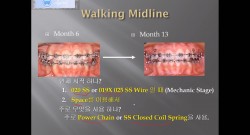 (강의 19) Sem #6 : Midline Correction