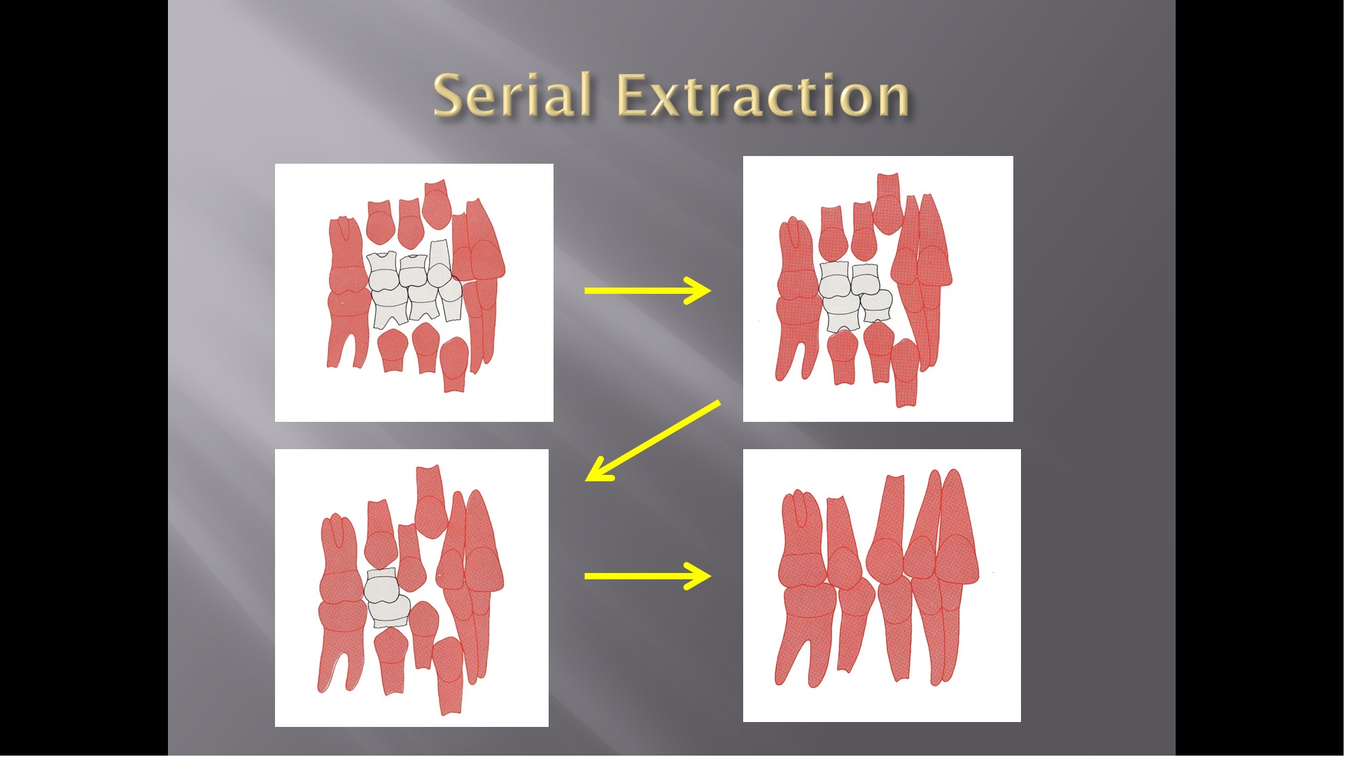 (강의 23) Sem #9 : Pedo-Ortho (Part 3)