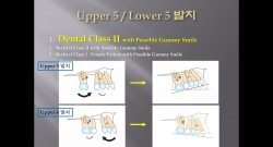 (강의 27) Sem #10 : Extraction (Part 5) - U5L5 발치