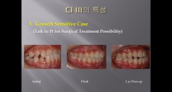 (강의 40) Sem #16 : Cl III. (Part I. Diagnosis and Characteristics)