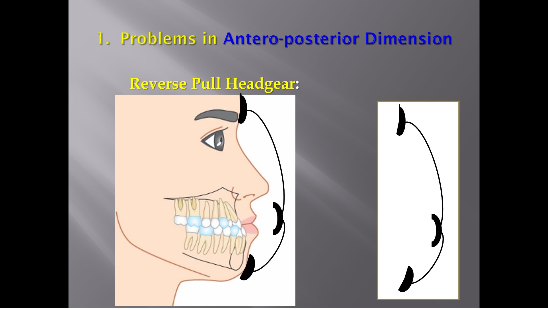 (강의 40) Sem #16 : Cl III. (Part IV. Treatment Plans.  4 Dimensions)