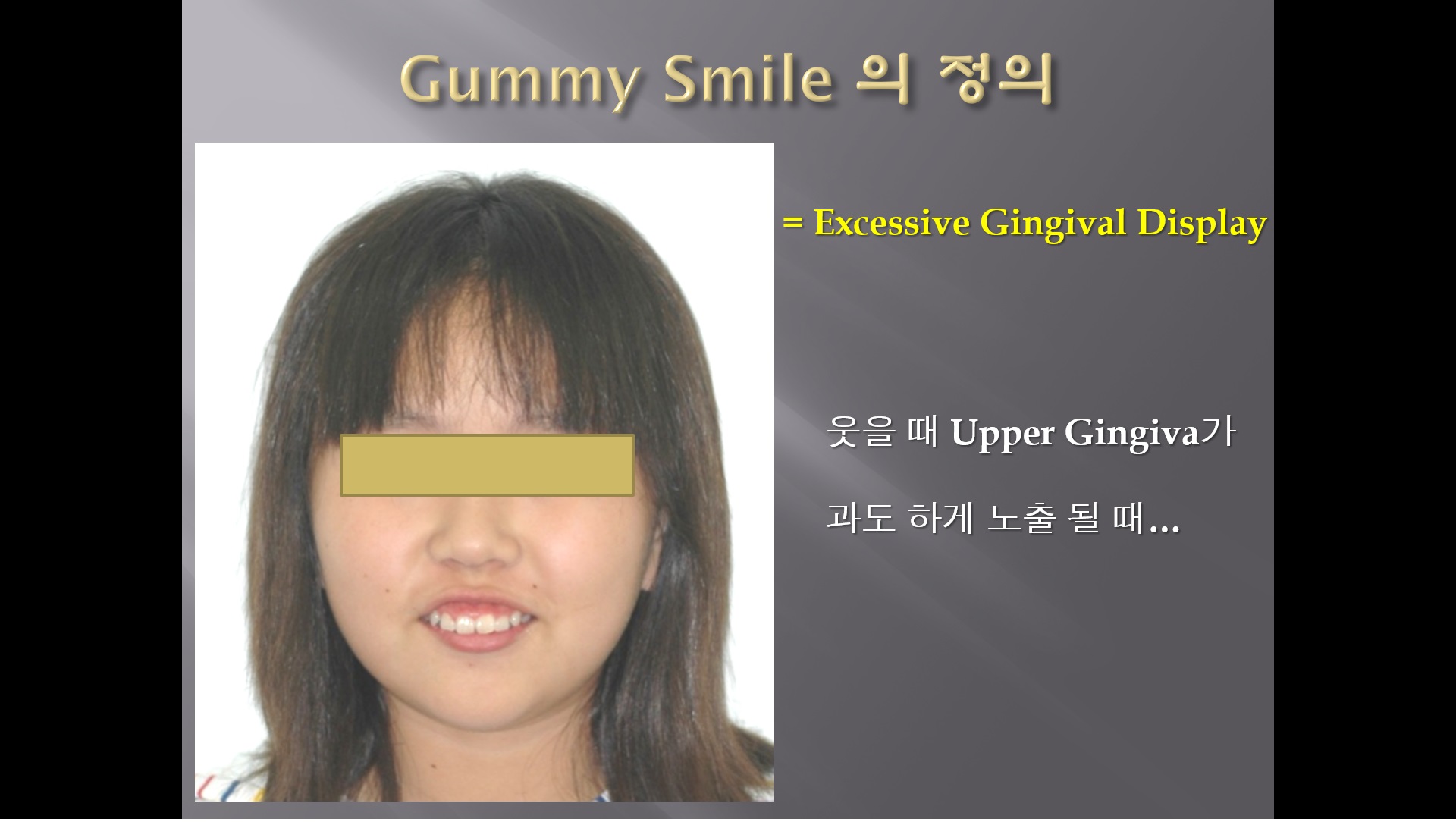 (강의 90) Sem #7.5 : Gummy Smile (Part 1-1)