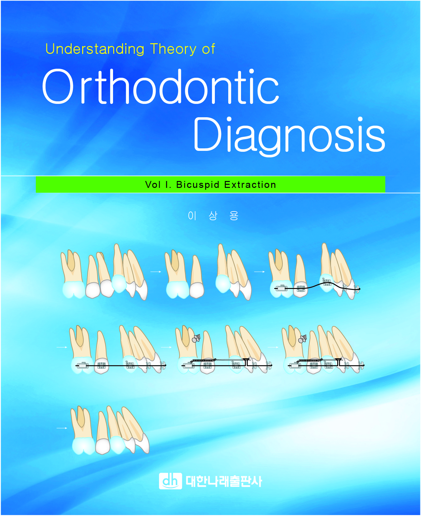 Understanding Theory of Orthodontics  Diagnosis (교정책)