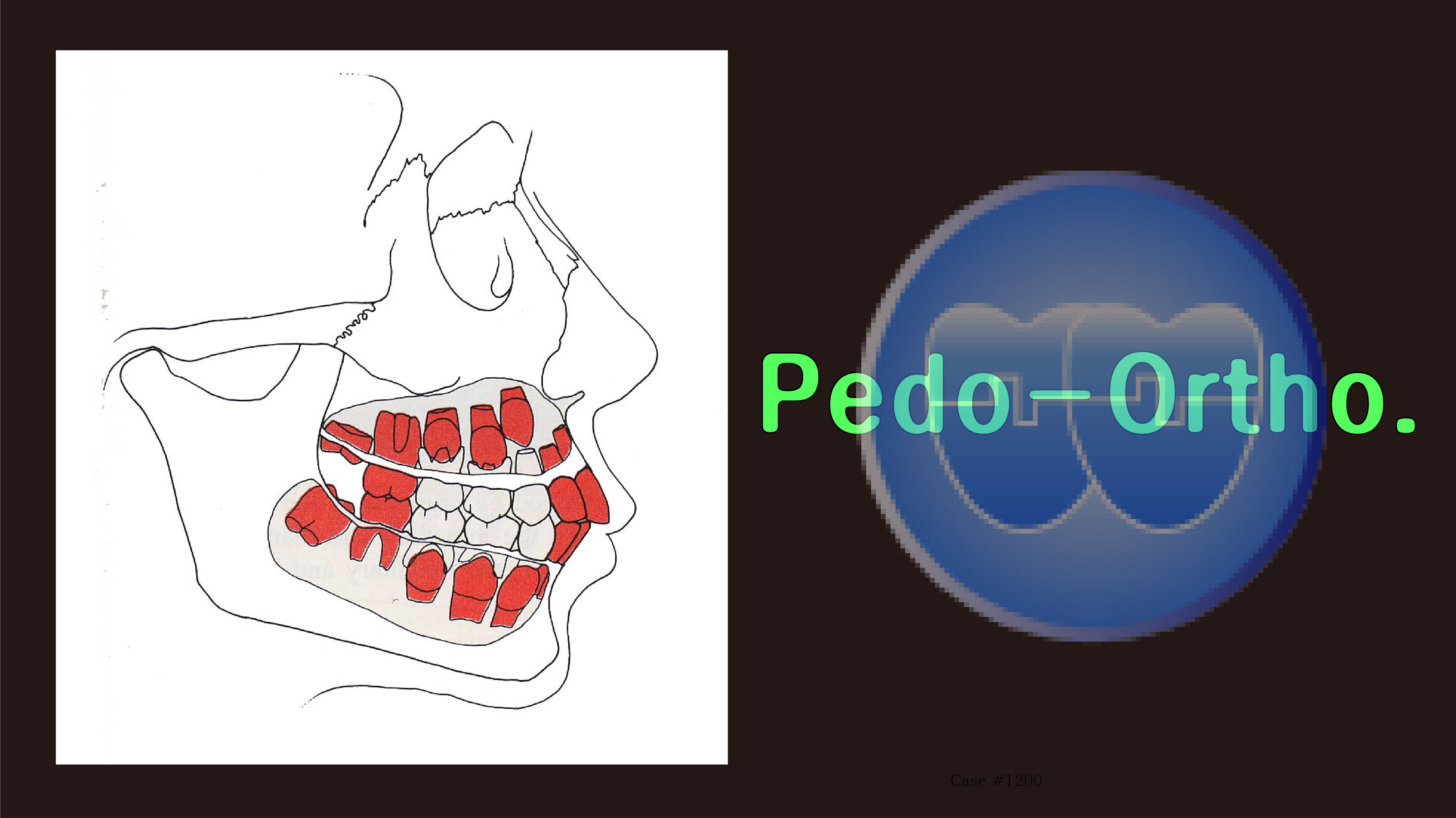 Pedo-Ortho. Course