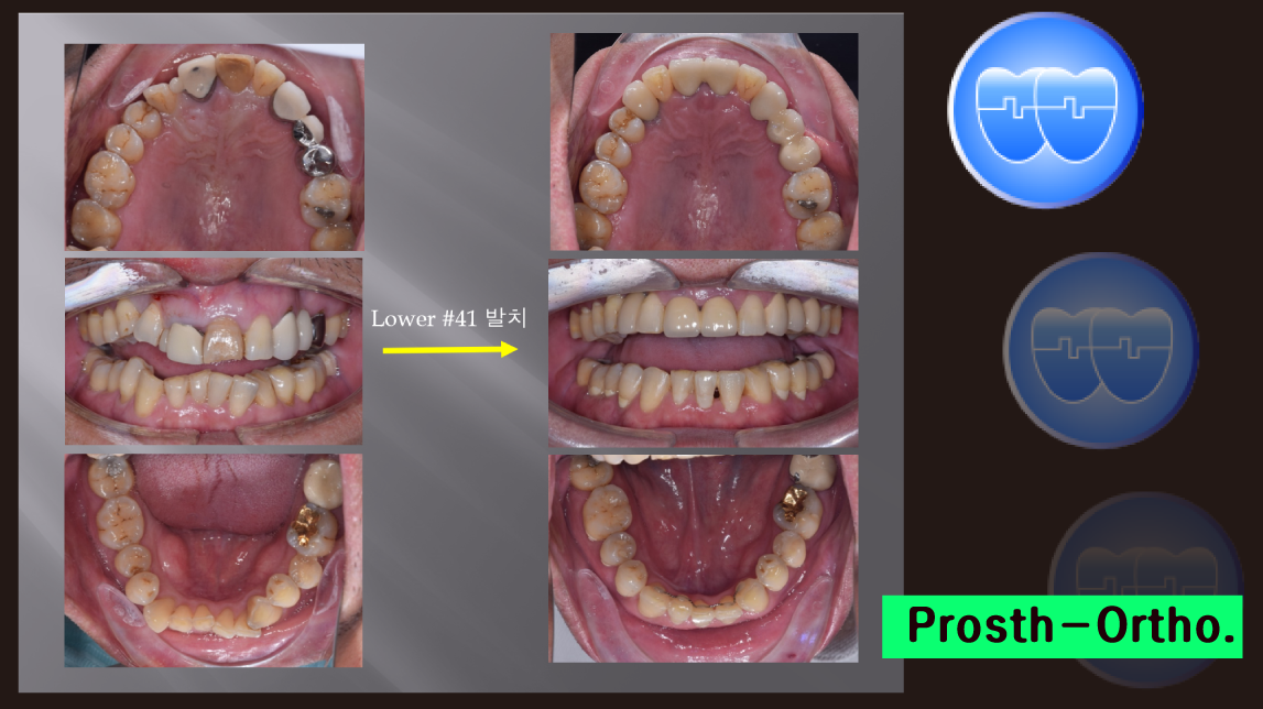 Prosth-Ortho. Course