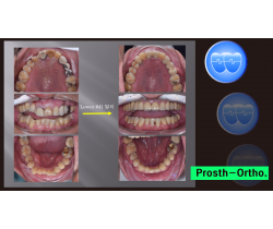 Prosth-Ortho. Course