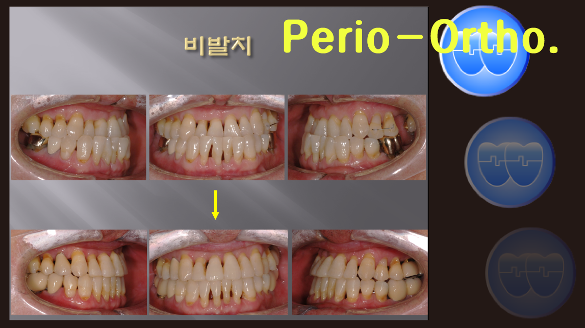 Perio-Ortho. Course