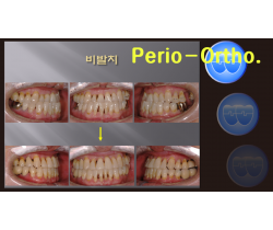 Perio-Ortho. Course