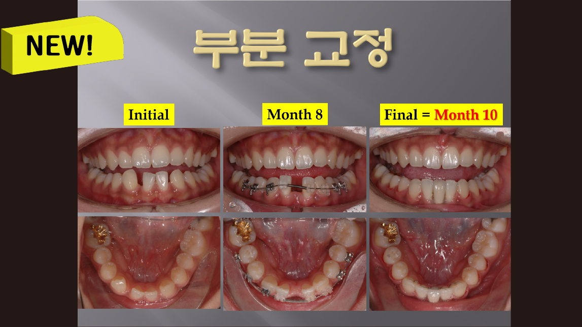 (강의 52) Sem #20.5 부분교정 강의 (Part 1)