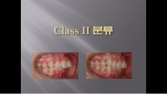 (강의 36) Sem #15  Class II. (Part I. Diagnosis and Characteristics)