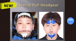 (실습 44) Reverse Pull Headgear(New)